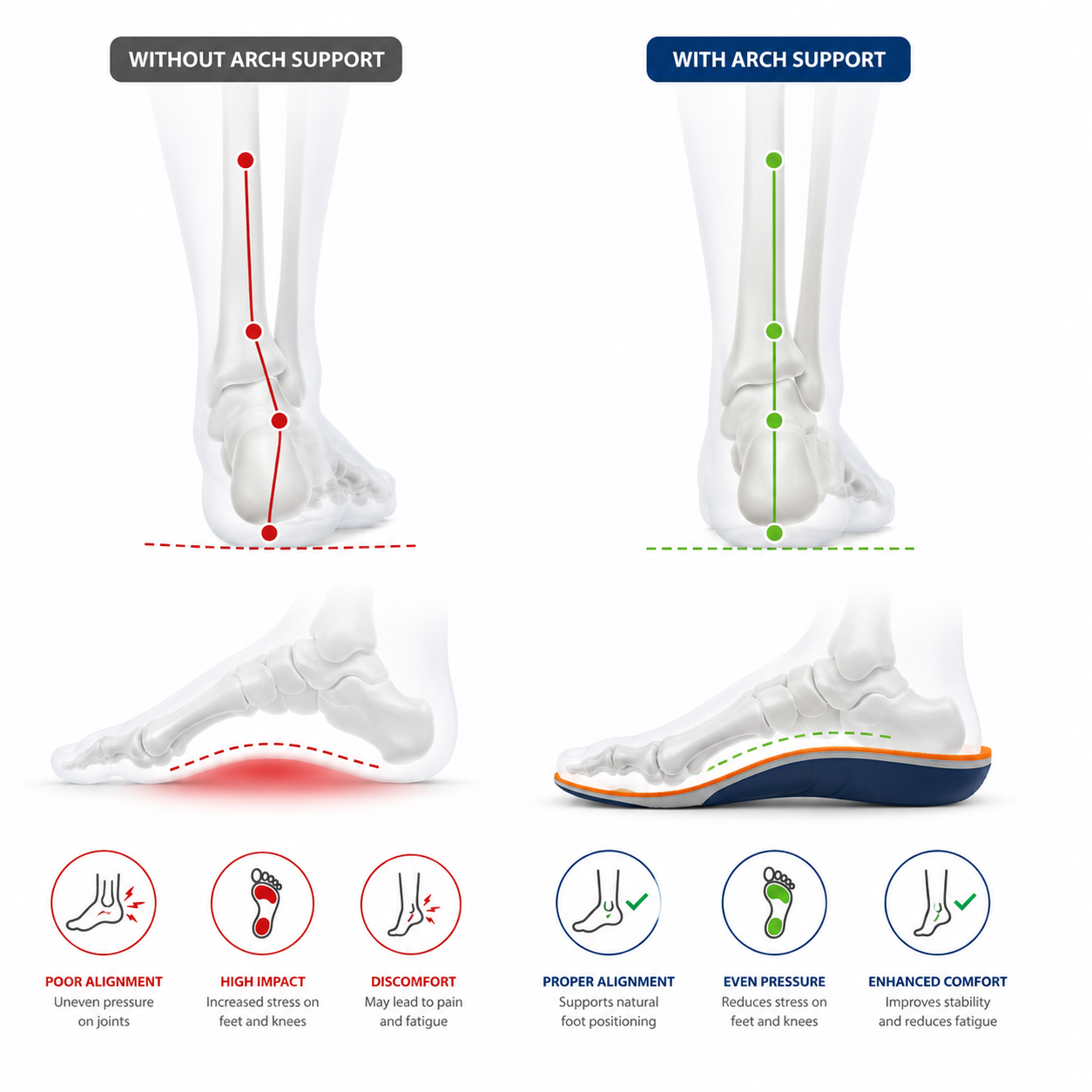 High Arch Support Insoles – Shock Absorbing Running & Walking Shoe Inserts