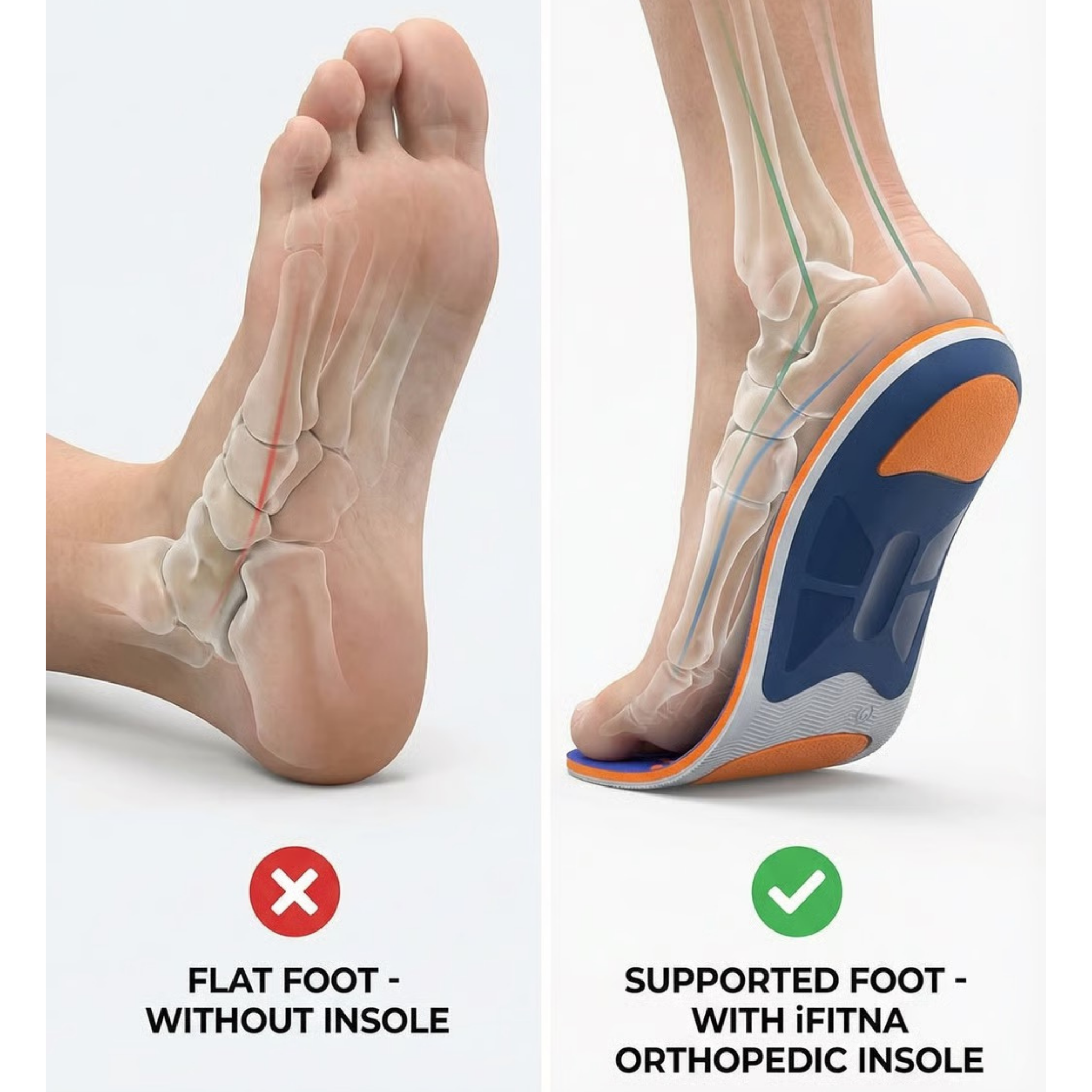 High Arch Support Plantar Fasciitis Orthopedic Shoe Sport Insole Men Women Flat Feet - Orthotic Plantillas Insert Sole